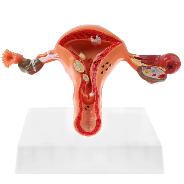 High-Quality Maxbell 1 1 Human Female Uterus Ovary Pathological Normal Model Anatomical Study Sustainable