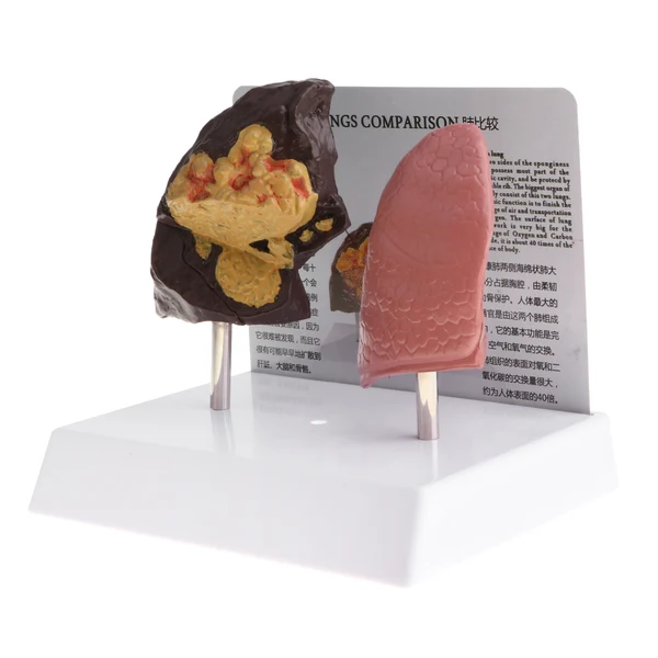 Dependable Maxbell Minify 1x Human Lung Normal Pathological Lab Demonstration Model Kits Learning Resources Pure