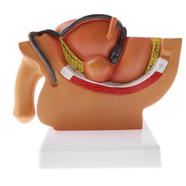 Powerful Maxbell 1 2 Sagittal Section Of Human Male Pelvis Testicle Prostate Structure Model School Teaching Display Kits Reliable