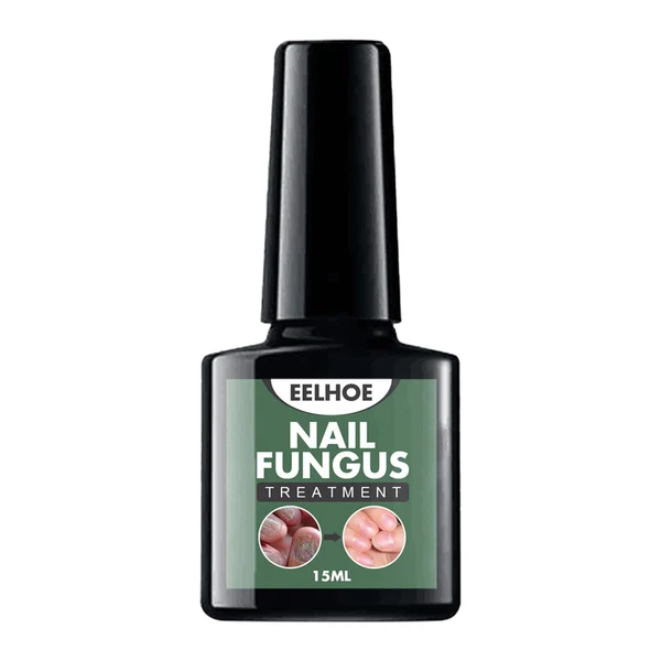 Enhanced Maxbell Nail Fungal Treatment 15ml Nails Manicure for Nail Cracking Discoloration Superior